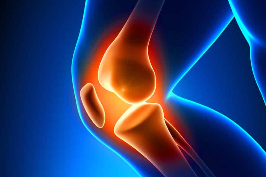 Knee Joint, Total Knee Replacement